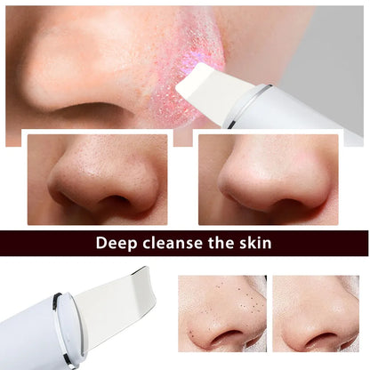 UltraScrub™ Ultrasonic Skin Scrubber